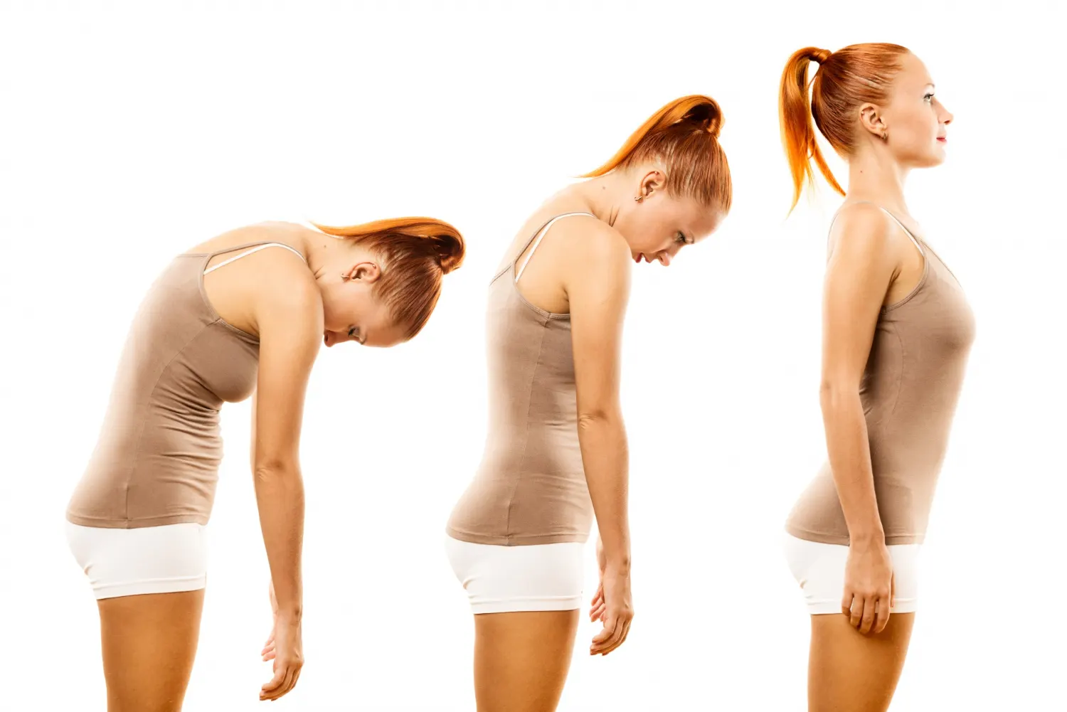 Three poses of a woman in a tank top highlight her scoliosis, demonstrating her body alignment