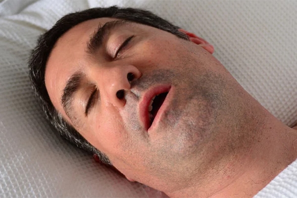 Mouth Breathing? Here’s How You Can Stop It