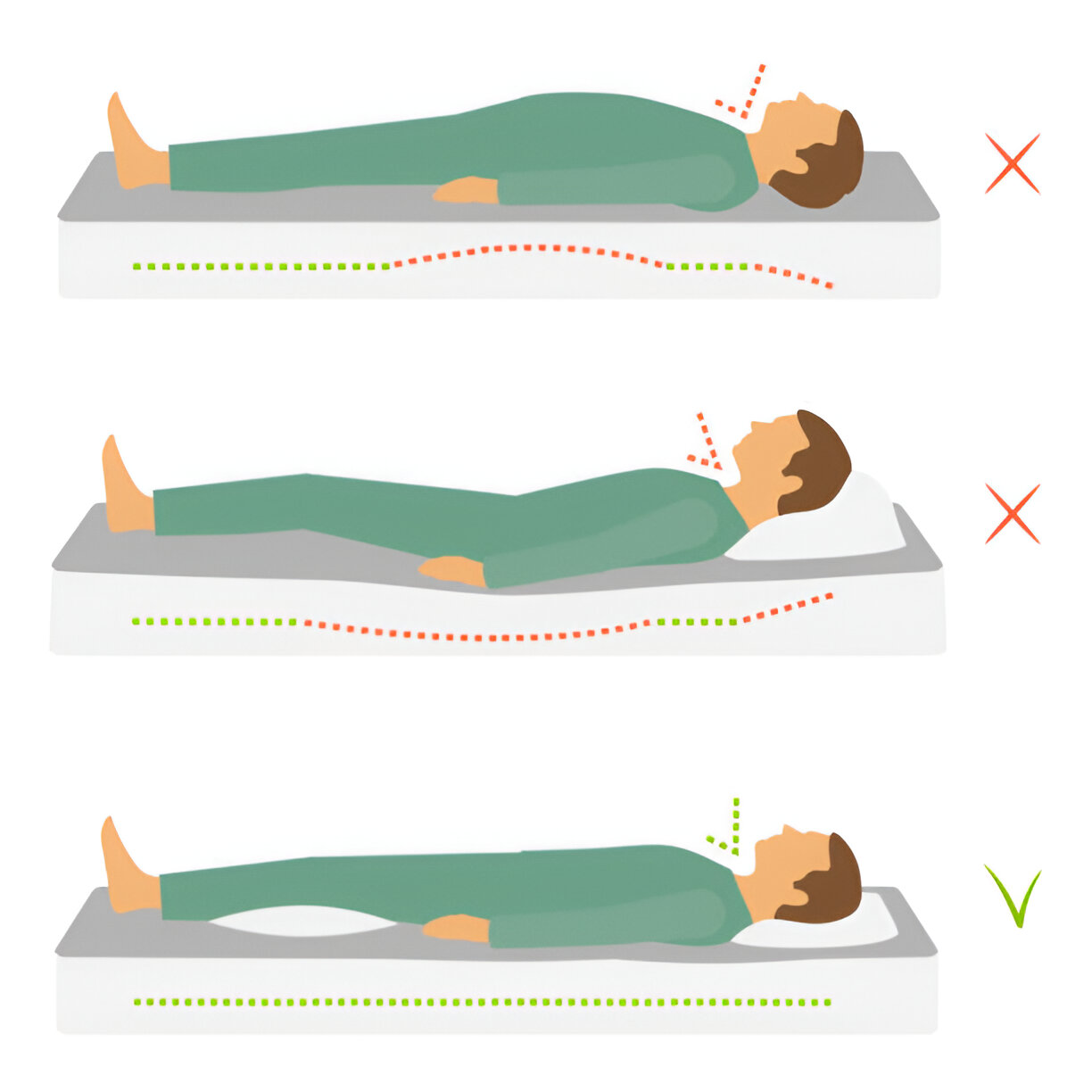 An image illustrating neck and spine posture while sleeping with and without a pillow on a mattress