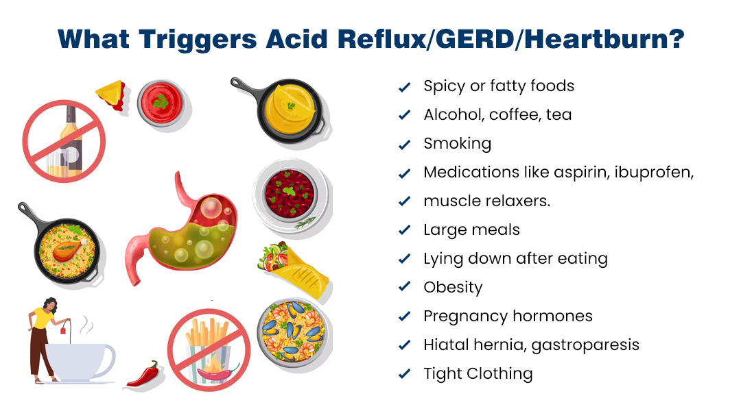 Foods and habits that trigger acid reflux/GERD/heartburn