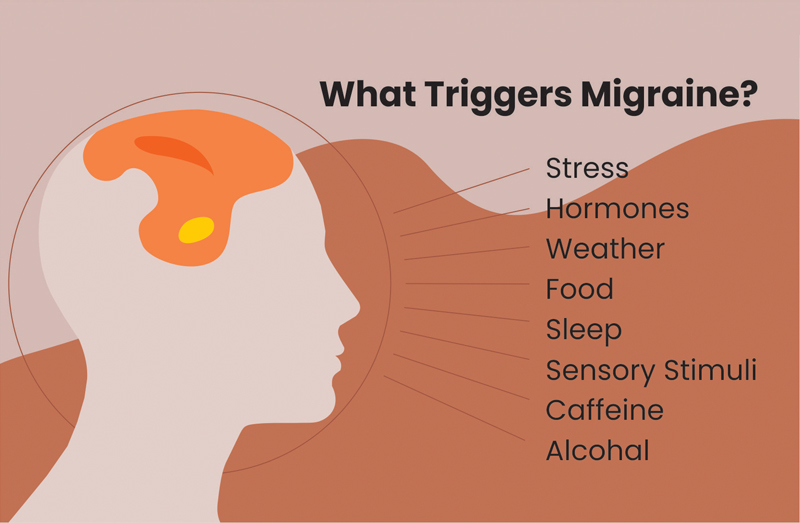 An image illustrating the factors that trigger migraine