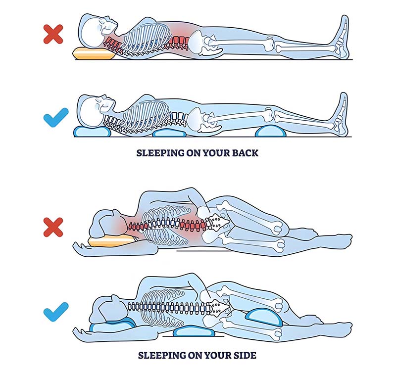 A Graphical Representation of Right and Wrong Back and Side sleeping posture