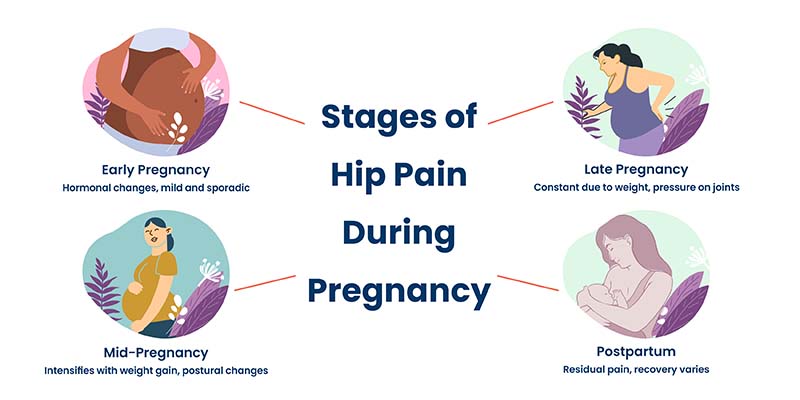 Stages of hip pain during pregnancy, illustrated