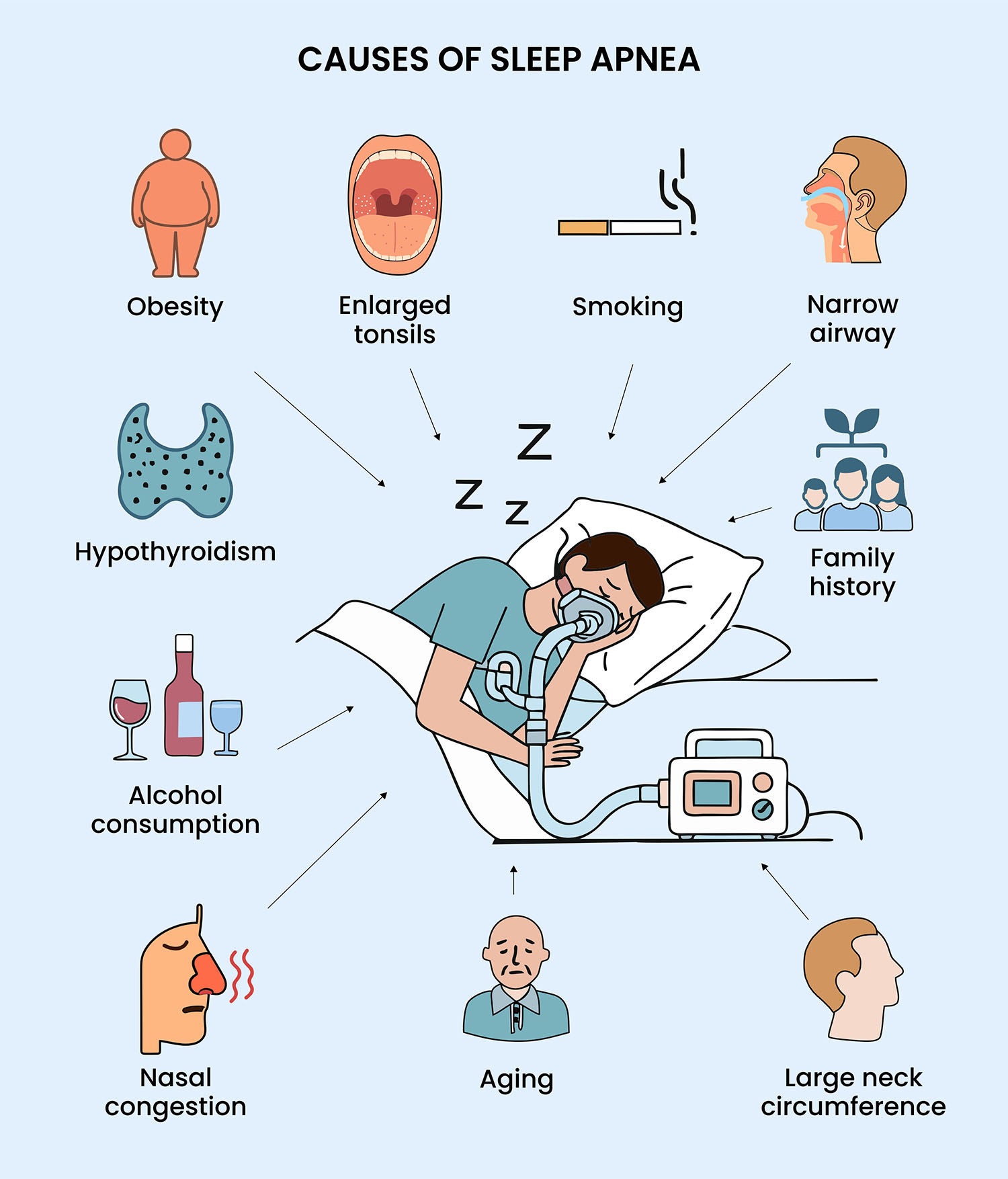 Several causes of sleep apnea illustrated vividly
