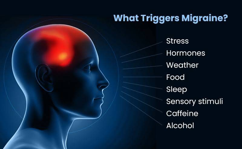 An image illustrating the factors that trigger migraine.