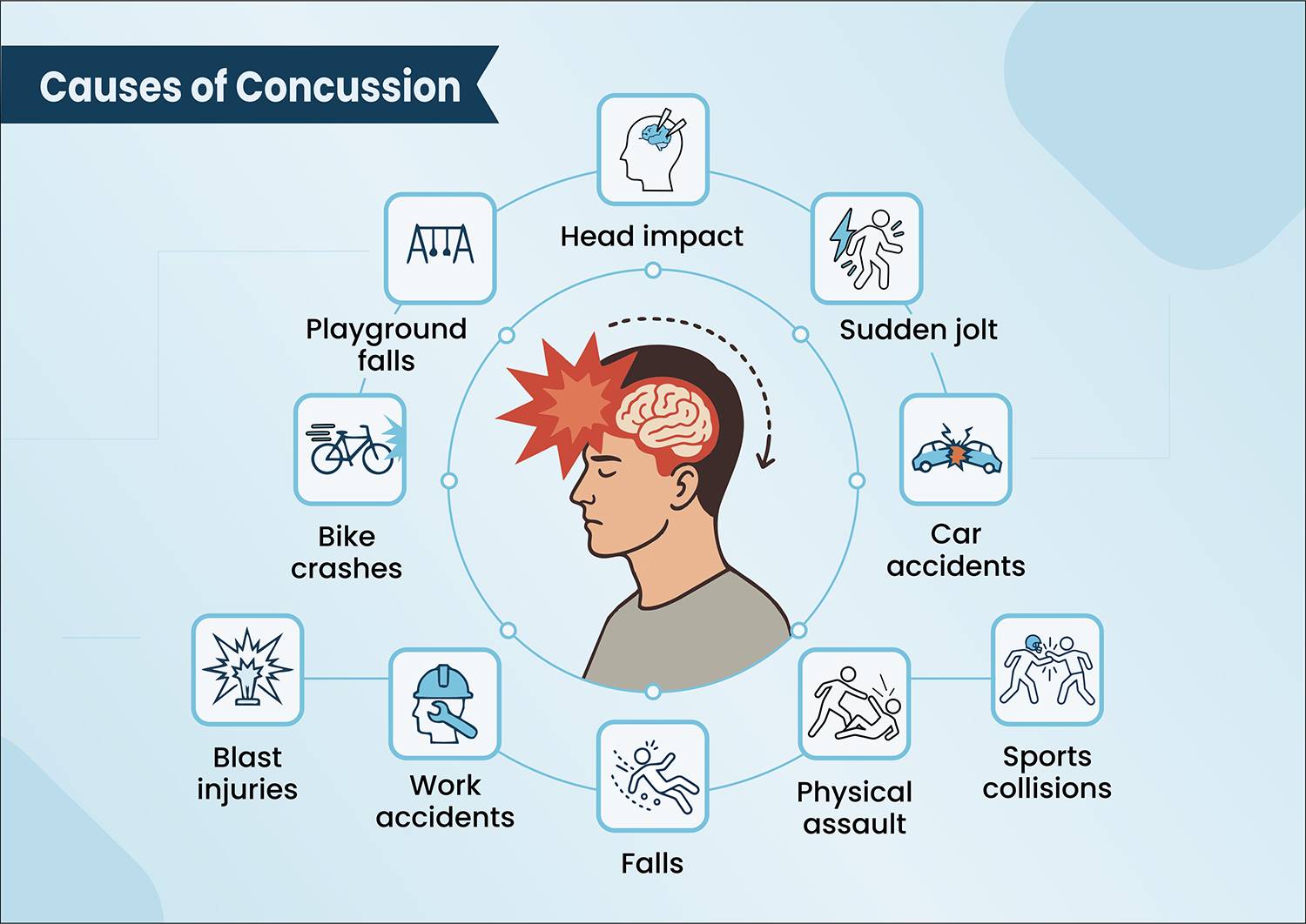 Causes of concussion illustrated for better understanding.