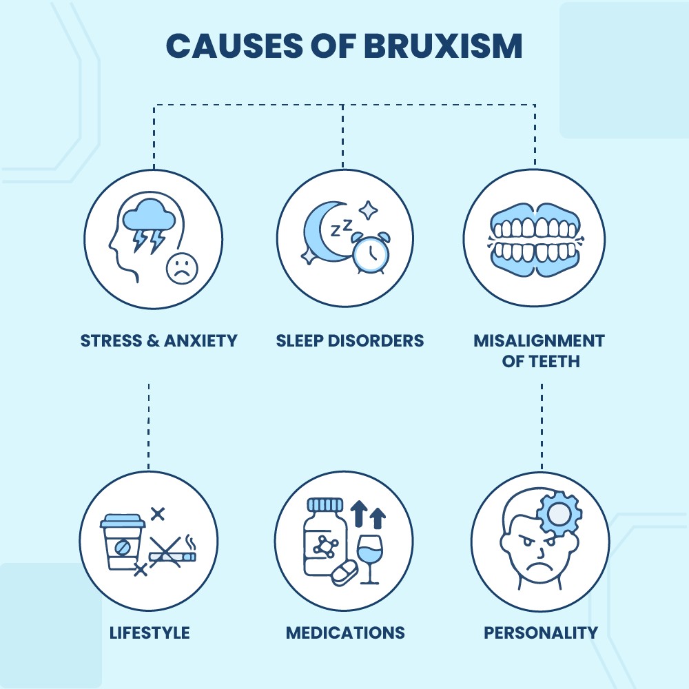 Causes of bruxism explained.