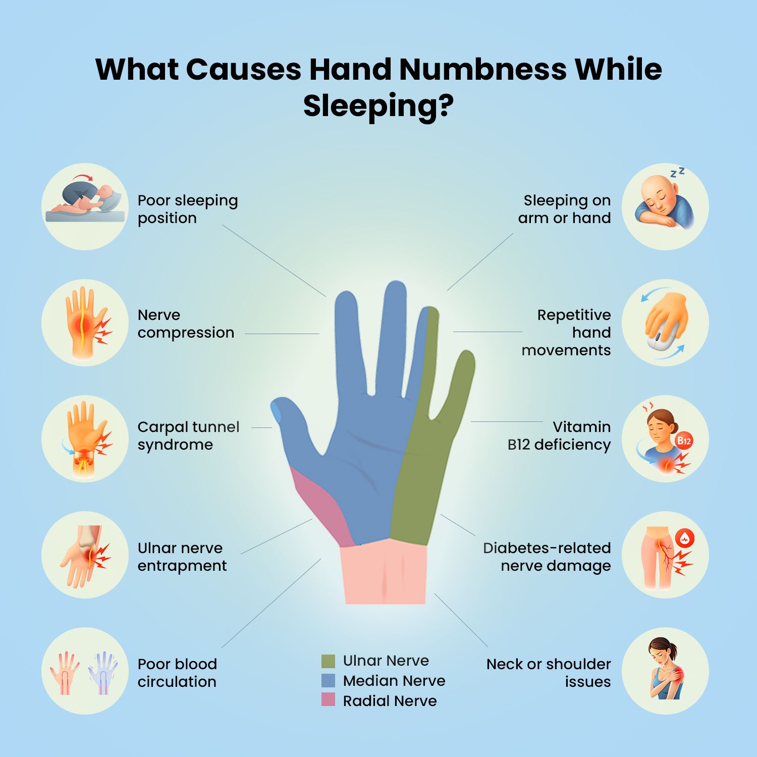 Causes of hand numbness while sleeping.