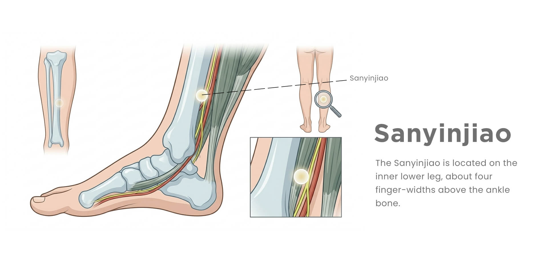 Sanyinjiao-three yin intersection